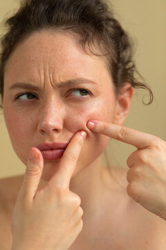 Sueezing pimple