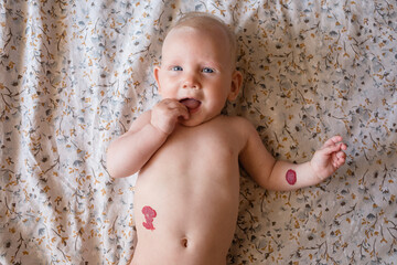 Five-month-old child with two cutaneous mark