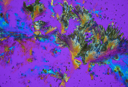 Vitamin B2 crystals under a microscope