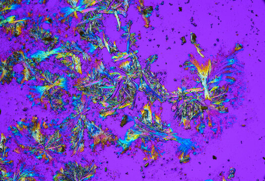 Vitamin B2 crystals under a microscope
