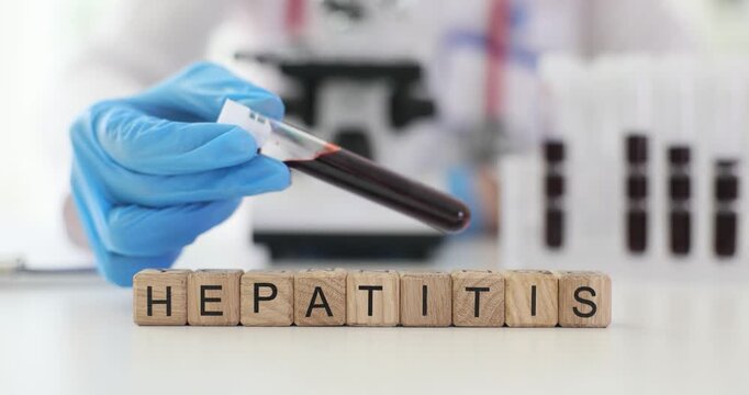 Blood test for hepatitis in the laboratory