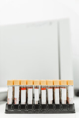 Scientific biotechnology analysis. Blood containers for researching