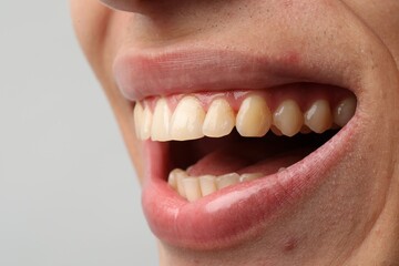Obraz premium Smiling man with healthy clean teeth on light background, closeup