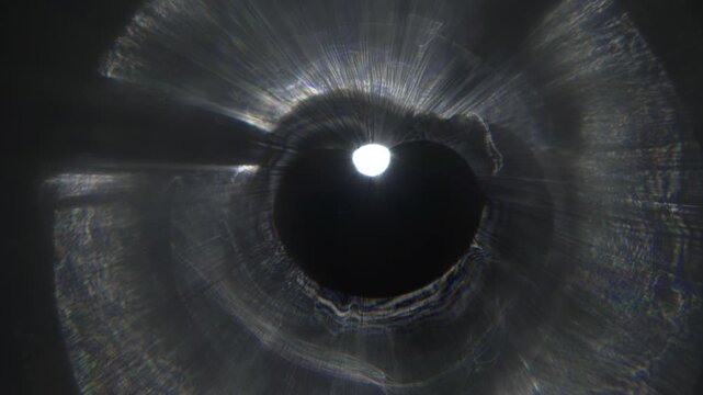 Detail of the refraction of the human crystalline lens, reflections in the lens.