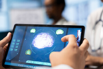 Medical expert looking at mri scan tomography results on tablet during a meeting with staff, review healthcare records and x rays. Collaborative efforts on diagnostics, neuroscience. Close up.