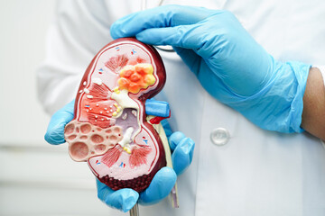 Chronic kidney disease, doctor with model for treatment urinary system, urology, Estimated...