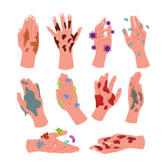 Set of dirty hands set collection, hand with many germs in mud and soil dirt, bacterial cells and bacilli on human palm, hygiene concept, kid cleaning concept, isolated on white background.