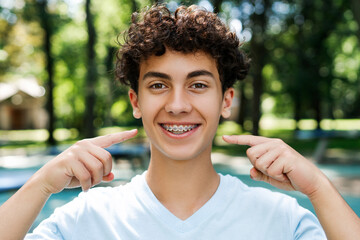 Smiling teenager boy posing at camera outdoor pointing to braces