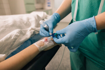 Venous access being established in a patient’s hand by a medical professional