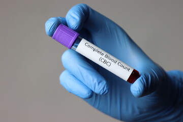 Blood test sample for complete blood count test in a healthcare professional wearing gloves and...