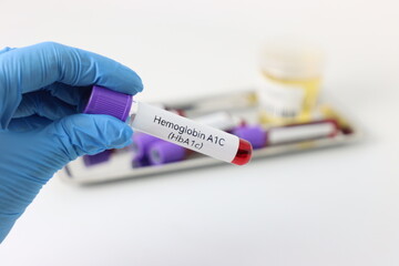 Different blood samples and urine samples in line to have a health check up 