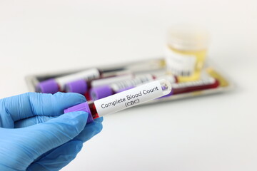 Blood test sample for complete blood count test beeing hold by a professional wearing gloves and...