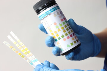 Professional wearing gloves holding a bottle of reagent strips for urinalysis 