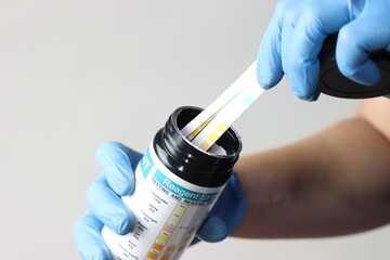 Professional wearing gloves holding a bottle of reagent strips for urinalysis 