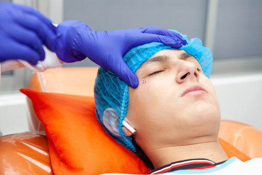 Skin lesion removal procedure. Dermatologist carrying out a removal of benign skin lesion on the face of a young male patient.