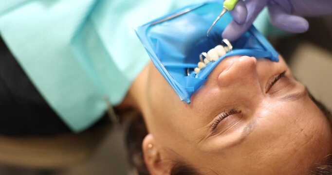 Female patient undergoes dental treatment procedure in private clinic. Dentist hand uses scaler to remove tartar from teeth slow motion