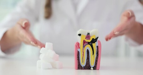 Dentist explains effect of sugar using tooth model in dentistry. Medic provides clear explanation of harmful influence of sweet products