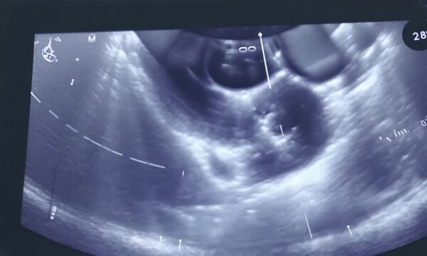 Pomeranian Pregnancy Scan. generative ai