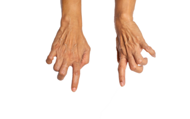 Transparent PNG Old hands on the skin, wrinkled, spastic symptoms On a white background