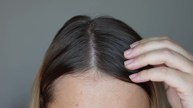 Young blonde woman applying essential cosmetic oil with a dropper to the parting rubbing it into the scalp with hands to strengthen, activate hair growth and reduce hair loss on a dark grey background