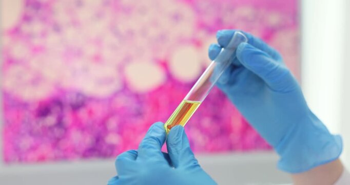 Lab assistant scrutinizes test tube containing yellow liquid. Scientist cross-references bio specimen fluid with data displayed on computer monitor