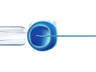 in vitro fertilization (IVF) Illustration sperm injecting