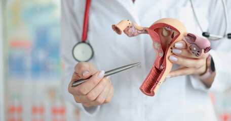 The doctor's hands hold a sectional model of the female reproductive organs, close-up. Training in gynecology and obstetrics