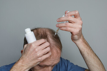 Man baldness treatment. Anti hair loss clinic serum. Nature hair care procedure. Male person...