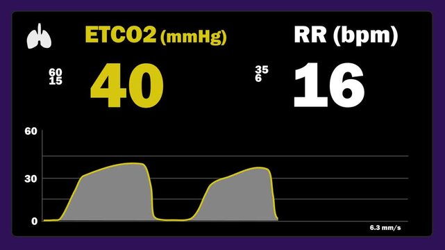 Capnography Monitor Equipment Screen - ETCO2 values , waveform and respiratory rate