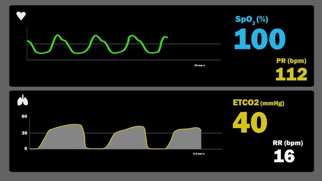 Vital Sign Monitoring - Pulse Oximetry and Capnography
