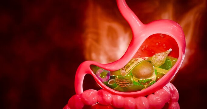 Symptoms of acid reflux or excess acid in the stomach. Gastric juice and intestinal model within the abdominal cavity. Burning sensation in the middle of the chest, acid reflux. 3D Rendering.