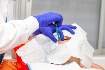 Skin lesion removal procedure. Dermatologist carrying out a removal of benign skin lesion on the...