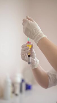 Doctor cosmetologist draws blood plasma into a syringe for the plasmolifting procedure, hands in gloves closeup. PRP therapy treatment in clinic. Cure of problem skin.