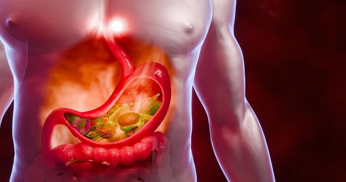 Symptoms of acid reflux or excess acid in the stomach. Gastric juice and intestinal model within the abdominal cavity. Burning sensation in the middle of the chest, acid reflux. 3D Rendering.