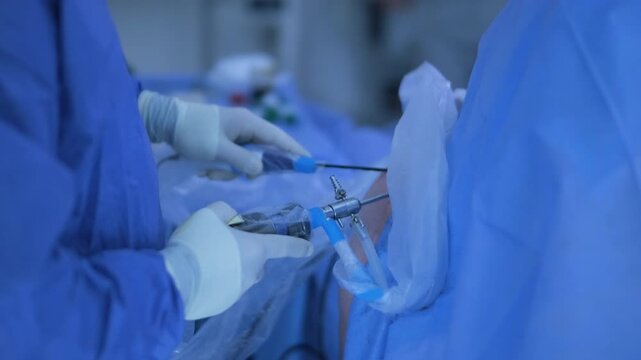 Arthroscopy of the shoulder joint