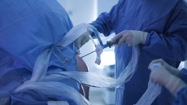 Arthroscopy of the shoulder joint
