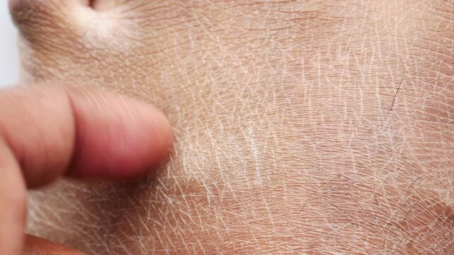 Closeup view of dry human skin .