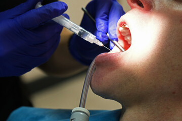 dentist holding a syringe