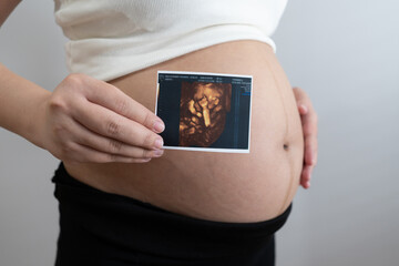pregnant woman holds an ultrasound photo of her baby, smiling as she gazes at the image. The ultrasound shows a clear picture of the developing baby, capturing a precious moment of motherhood