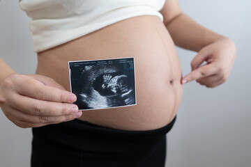 pregnant woman holds an ultrasound photo of her baby, smiling as she gazes at the image. The ultrasound shows a clear picture of the developing baby, capturing a precious moment of motherhood