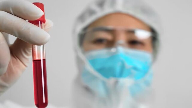 Blood test. Medical staff wearing protective clothing makes laboratory research analyzing blood sample in test tubes. Detection of antibodies in clinic. Serological testing in hospital.