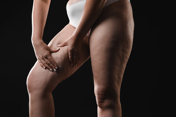 Naklejka premium Woman with cellulite on black background, closeup