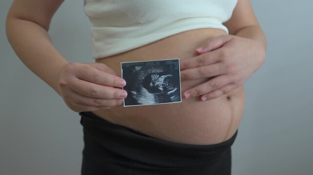 pregnant woman holds an ultrasound photo of her baby, smiling as she gazes at the image. The ultrasound shows a clear picture of the developing baby, capturing a precious moment of motherhood