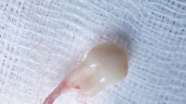 Close-up of tooth that had just been extracted had red blood stains stuck to the root, teeth from tooth extraction by the dentist, Tooth extraction concept, macro.