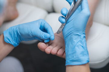 Obraz premium Hands in blue medical gloves folded in the shape of a heart on a white background. Foot care. Podologist