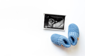 Ultrasound image of a fertilized egg. Planning a baby. Pregnancy and conceiving a child concept