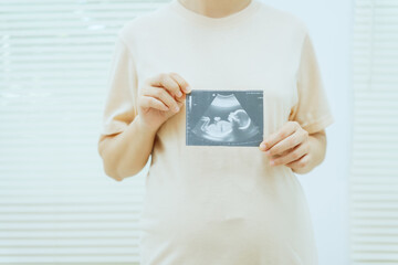 A middle-aged pregnant Asian woman is isolated on a white background, highlighting her maternity...
