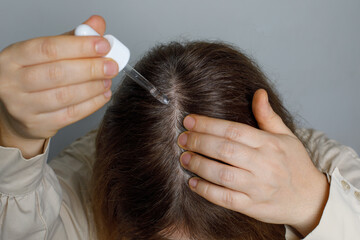 Women suffering from hair loss using hair serum or minoxidil to treat alopecia and hair loss