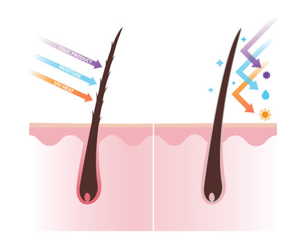 Comparison of damaged and healthy hair shaft on scalp layer vector illustration. Open cuticle absorb ultraviolet, heat, moisture and toxic product, cause hair damage. Closed cuticle can reflect them.