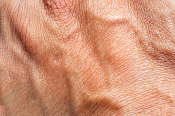 Macro human skin texture,Macro human hand skin,Macro human hand texture,The texture of the skin of...